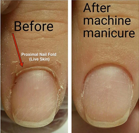 manucure-russe-dangers-risques-ongles3
