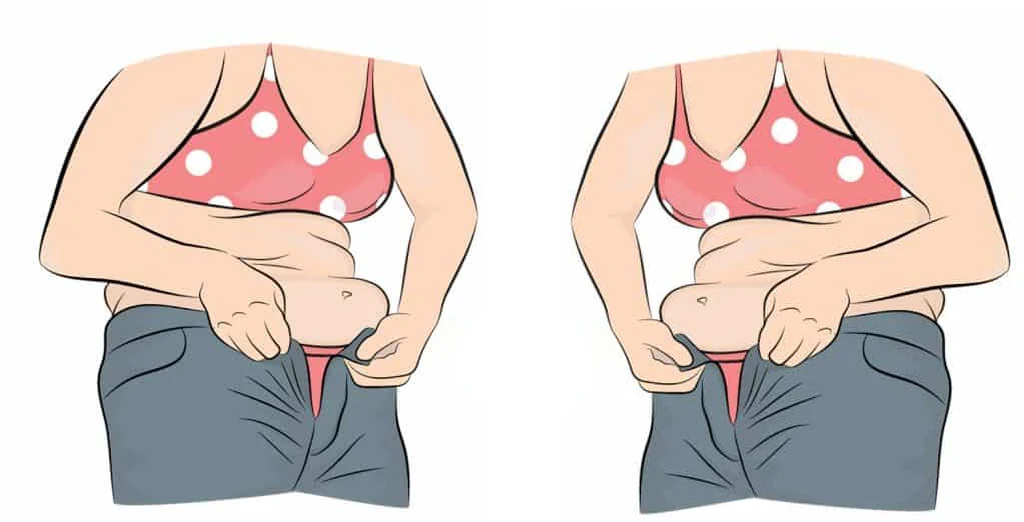 Graisse abdominale : pourquoi il est urgent de s’en occuper