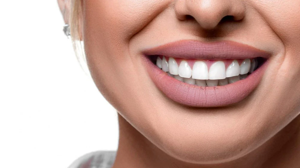 "Je ne peux plus manger sans douleur" : les victimes du Hollywood Smile parlent