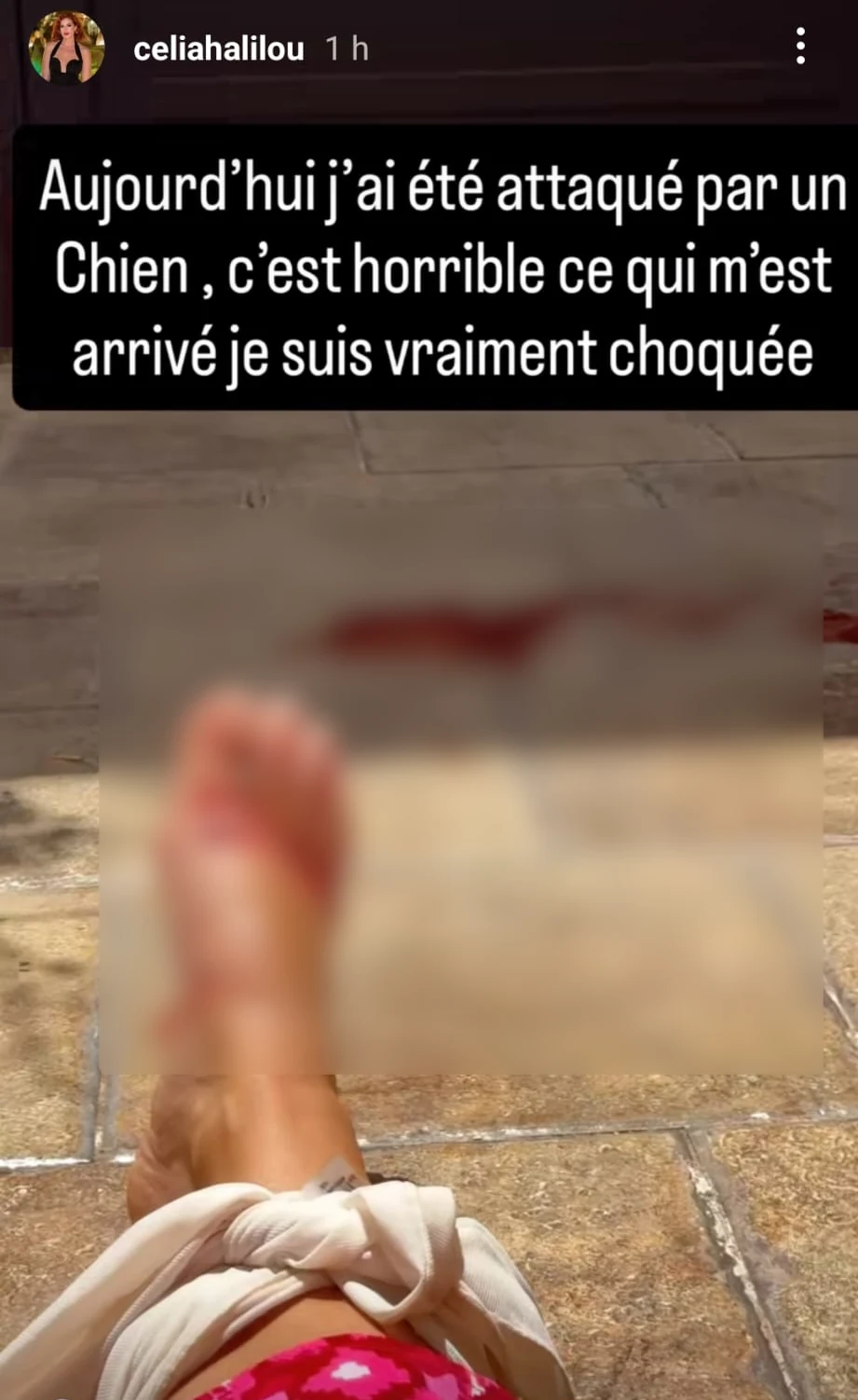 chiens-errants-algerie-influenceuse-attaque-galoufa-celia-halilou