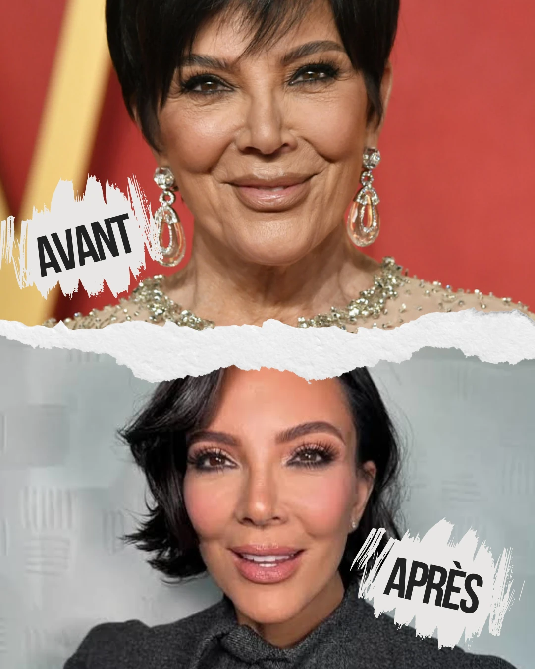kris-jenner-facelift-avant-après